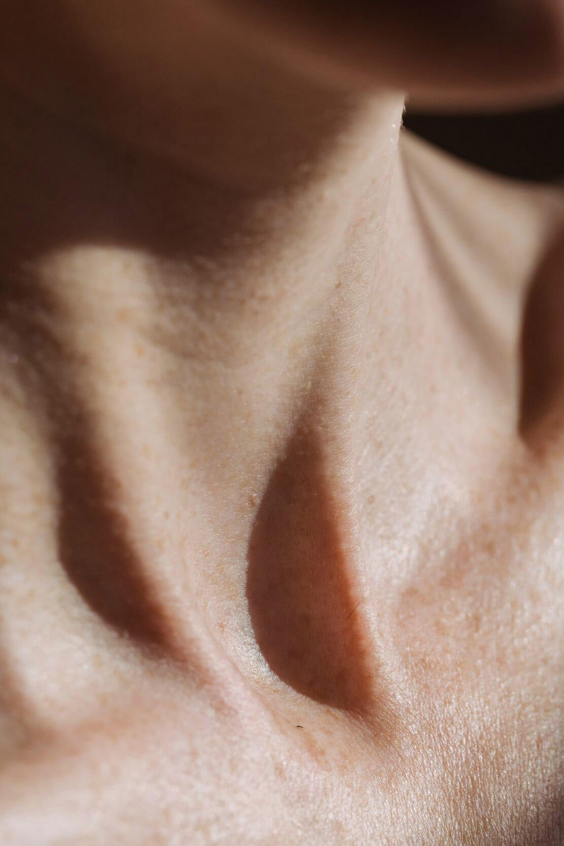 Face and Neck Lift Surgery Dr Vaca MD is face and neck lift right for you 3